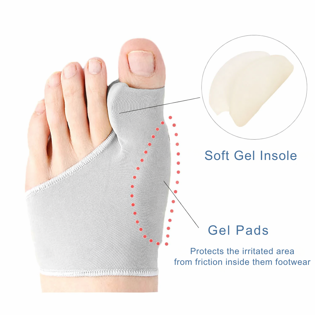Toe Separator & Bunion Support Sleeve – Soft Gel Pressure-Relief Corrector